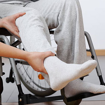 physiotherapy